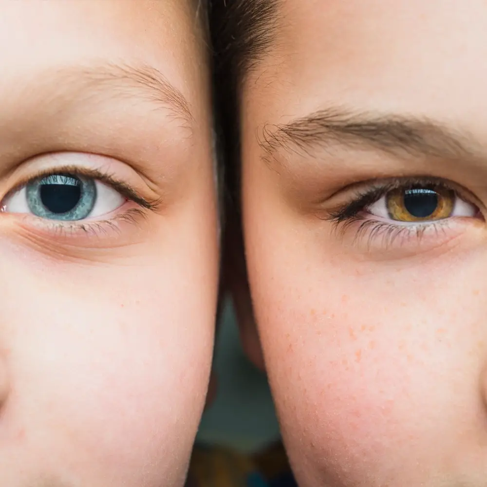 Clínica de Cirugía Refractiva Quítate Los Lentes — Roma Norte CDMX