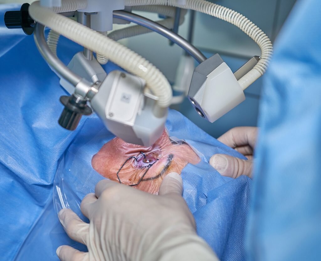Cuidados postoperatorios de Cirugía Lasik: todo lo que tienes que saber