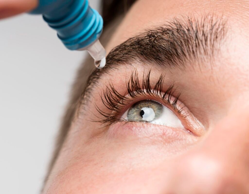 Cirugía de cataratas en pacientes con ojos secos: ¿qué precauciones se deben tomar?