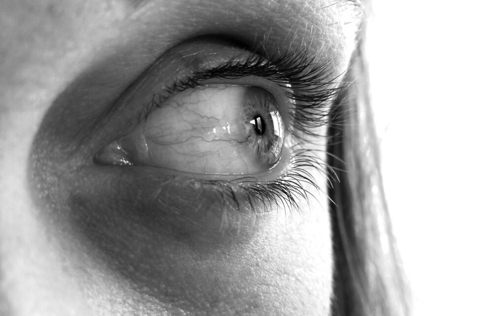 Vasculitis Retiniana: Causas, Síntomas y Tratamientos