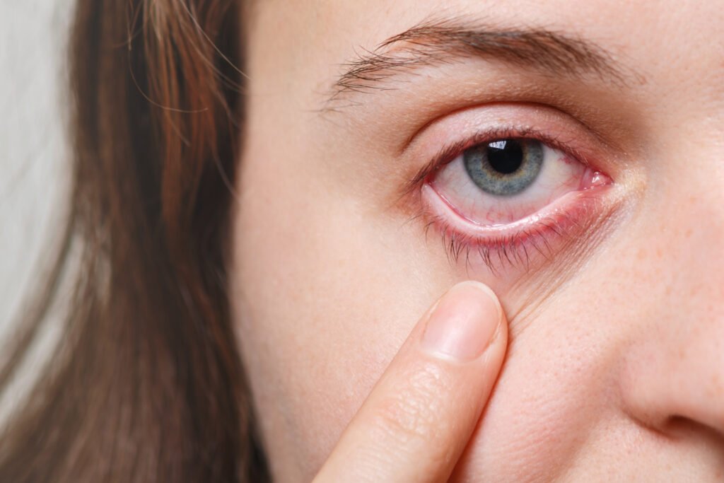Sequedad ocular: causas, tratamientos y consejos