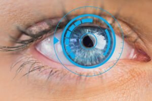 Cataratas y astigmatismo: corrección simultánea con lente tórico